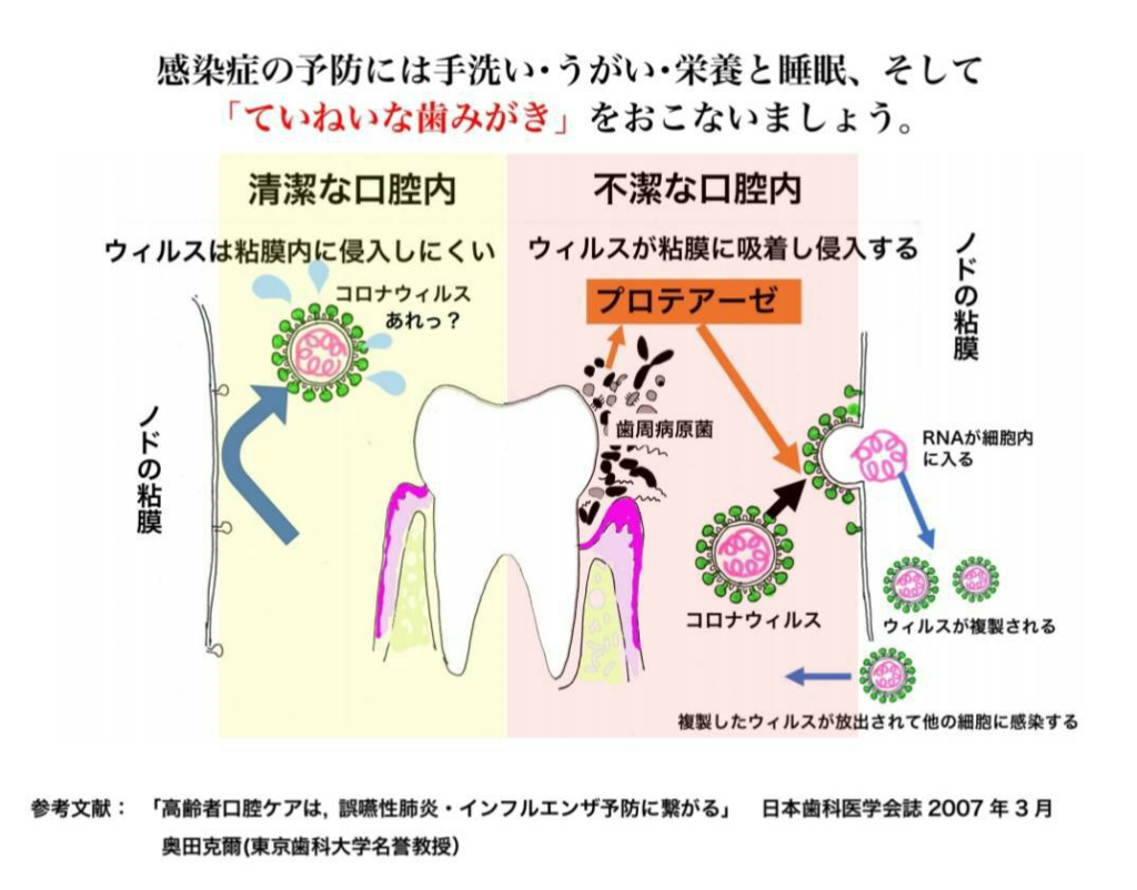 感染症予防にプラークコントロールしませんか？｜那須塩原の歯医者